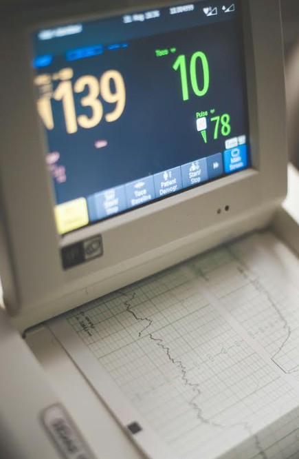 CARDIOPATÍAS CONGÉNITAS EN EL SÍNDROME DE DOWN