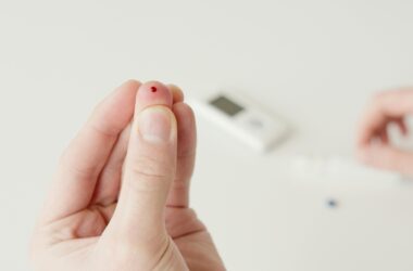 Diabetes mal controlada