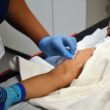 Investigación chilena que busca prevenir quemaduras infantiles recibe premio internacional