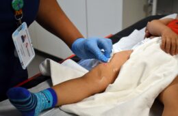 Investigación chilena que busca prevenir quemaduras infantiles recibe premio internacional
