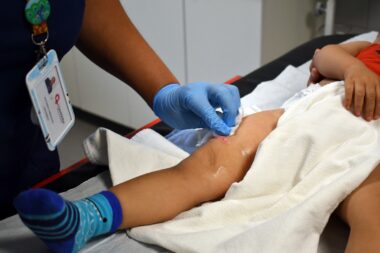 Investigación chilena que busca prevenir quemaduras infantiles recibe premio internacional