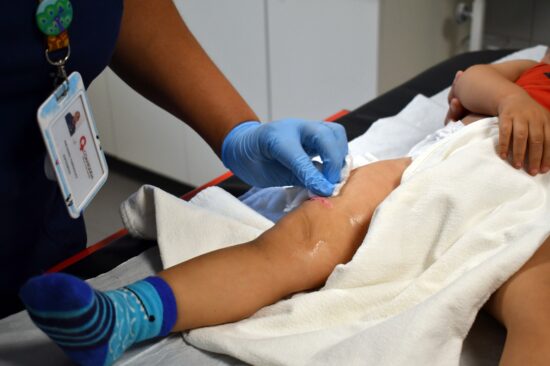Investigación chilena que busca prevenir quemaduras infantiles recibe premio internacional